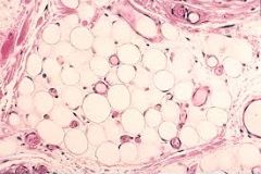 adipose (fat) cells