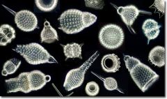 Marine amebas with tests made of silica; thin pseudopods can be extended through small pores
