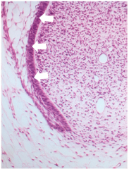 The cells at the arrows
represent?
a) odontoblasts
b) ameloblasts
c) inner enamel epithelium
d) outer enamel epithelium
e) cementoblasts