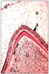Which of the following
structures has been mislabeled?
a) stratum intermedium
b) dental papilla
c) membrana preformativa
d) outer enamel epithelium
e) stellate reticulum