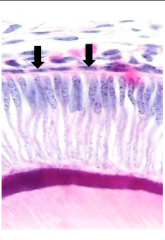 The arrowed cells
represent?
a) ameloblasts
b) odontoblasts
c) stellate reticulum
d) inner enamel epithelium
e) stratum intermedium