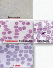 Plasmodium is transmitted by the Anopheles mosquito and humans are the only reservoir. There are four main species: P. vivax, P. ovale, P. malariae, and P. falciparum. The life cycle in humans is broken down into an exoerythrocytic and erthrocytic...