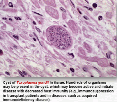Toxoplasma gondii causes fever, chills, headache, myalgia, lymphadenopathy in the acute setting. In the chronic setting causes lymphadenopathy, rash, hepatitis, encephalopathy, myocarditis. Can infect the CNS in HIV/immunocompromised patients whic...