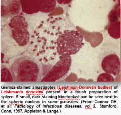 Tissue biopsy showing intracellular parasites. Can do serology for visceral form. 