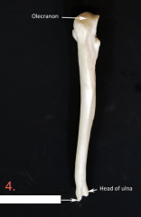 Ulna: 
(medial forearm: arti. prox. w/ humerus & later. w/ radius)
1. Olecranon Process (contains elbow)
2. Trochlear Notch
3. Coronoid Process
4. Styloid Process 


NotLabeled: lateral to Coronoid Process is Radial Notch (art. w/ head of radius)