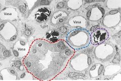 Red = collecting ducts
Blue = thin limbs of loop of Henle 
Purple = vasa recta (note there are also some vasa recta w/out RBCs)