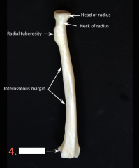Radius:
(lateral forearm)
1. Head (proximal)
2. Radial Tuberosity (anterior-medial)
3. Styloid Process (lateral) 
4. Ulnar Notch (medial)