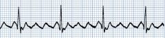 What kind of ECG are we looking at?