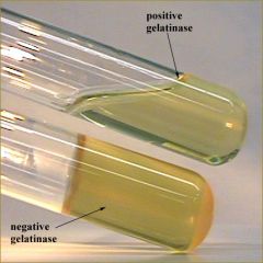 Bacteria with enzyme gelatinase, can break down gelatin into a liquid


 


Serratia = positive


 
