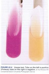 Pink = positive


Peach = negative


 


Organisms with enzyme urease will hydrolyze urea, releasing ammonia (an alkaline end product, causing pink color)


**Proteus = positive