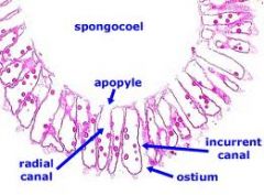 syconoid sponge
[spongocoel, ostium, radial canal, incurrent canal, apopyle]