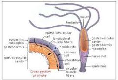 Whole mount: 
-basal disk, hypostome (under mouth), mouth, tentacle

Cross section:
-epidermis, gastroderm, mesoglea, gastrovascular cavity