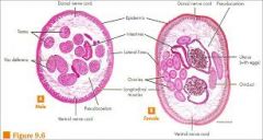-nerve cords, epidermis, pseudocoelom, longitudinal muscles, lateral lines, intestine
-female: ovary, oviduct, uterus, eggs
-male: testis, vas deferens
