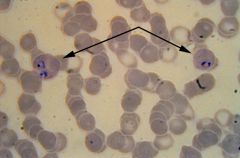 in phylum apicomplexa; causes malaria; leads to signet ring stage in RBCs
