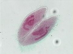 sexual reproduction; micronuclei are exchanged to exchange genetic material (no increase in number of protozoa tho)