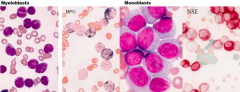 - Myeloperoxidase (MPO - generates a black intracellular product)
- Non-specific esterase (NSE - generates a brick-red intracellular product