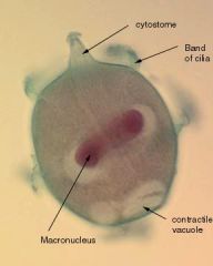 in phylum ciliophora; carnivorous protozoan that feeds on paramecium and other protozoan; contains 2 bands of cilia and cystoscope (mouth) and contractile vacuole