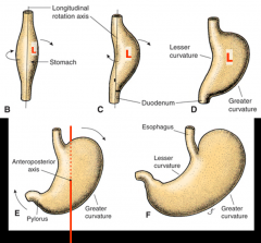 -Initially stomach develops as a fusiform swelling of gut
-first rotates 90 degrees around longitudinal axis
--> original L side becomes anterior
-then rotates 90 degrees around anterioposterior axis----> lesser curvature faces up/R & greater f...