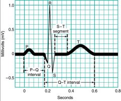 The T-wave measures ventricular repolarization (which occurs as the ventricles relax). 