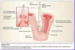 Afferents from Baroreceptors (carotid sinus) and chemoreceptors (carotid body) are carried by IX and project to the caudal part of the _____ _____ and tract.