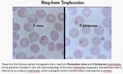 Blood should be drawn and examined at 6, 12, and 24 hrs after initial sample. This is a thin film sample showing rings in the RBCs. On a thick film you won't see this as the RBCs are lysed. Instead you will see mature parasites. 