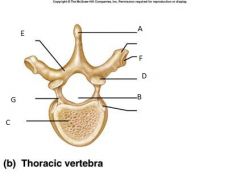 Label this Lumbar Vertebra