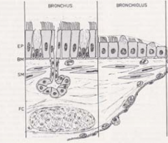 Both have:
- Ciliated Cells = cells covered in tiny hair-like projections known as cilia (epithelial cells). 
- Smooth Muscle

Unlike the bronchi, the bronchioles is thinner and does NOT have: 
- Mucous Glands/Goblet Cells
- Cartilage