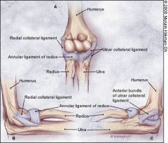 What is the most common mode of failure of the lateral ulnar collateral ligament associated with an elbow dislocation? 
1.  ligament avulsion off the humeral origin 
2.  ligament avulsion off the ulnar insertion 
3.  midsubstance rupture 
4.  ...