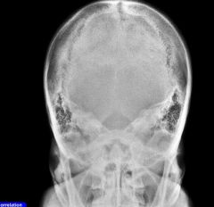 What is/are the repeatable errors in this skull image?