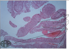 Identify the papillae, transitional epithelium, and fibrovascular core.


What do the individual finger-like papillae have a central core of? Covered by what? 