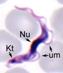 African trypanosoma
Trypomastigote
Kt=Kinetoplats
Nu=nucleus
um=Undulating membrane