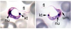 Trypanosoma cruzi trypomastigote
Kt=Kinetoplast
Nu=Nucleus
Fl=Flagellum
um=Undulating membrane