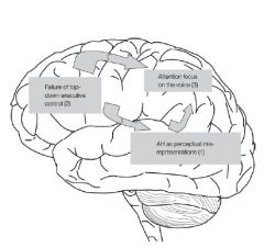 Outline of a model for
auditory hallucinations
(AH) as perceptual
mis-representations,
parietal lobe attention
enhancement and
failure of prefrontal
executive suppression
control. The model
emphasizes the
involvement of the
middle and s...