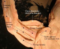 Origin: Caudal border of scapula/proximal border of humerus
Insertion: Olecranon of ulna
Action: Extends elbow/flexes shoulder
Opposing Muscle: Biceps brachii