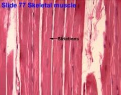 -Involved in movement of skeleton
-Can be controlled voluntarily
-Forms bulk of body
-Striated
-More than one nuclei