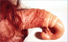 Developmental disorder often seen in BULLS where the ventral PENIS is connected to the PREPUCE causing penile deviation.