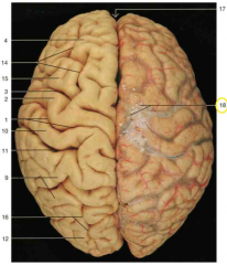 What layer of covering is seen on the right hemisphere of the brain (right side of the image)? What structures are shown by 18 (yellow circle)?