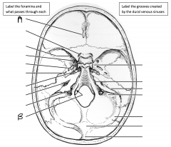 What foramen is identified by A and what passes through it? What foramen is identified by B and what passes through it?
