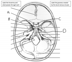 What foramen is identified by A and what passes through it? What foramen is identified by B and what passes through it? What is the space found within C? What is the bone identified by arrow D?