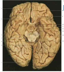 Identify the lobes of the brain in this image (3)