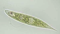 plant and animal like
have chlorophyl- photosynthetic 
can be heterotropic 
unicellular flagellated protists