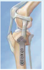 Tibial Plateau Levelling Osteotomy.
Man flytter en stor del af tibia caudalt.
Svær og meget invasiv procedure!