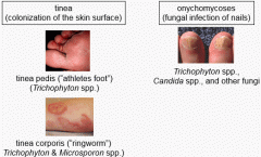 Fungal infections that colonize keratinized layers (they secrete keratinase). They are non-invasive but infections may elicit host response (inflammation). Itchy, scaly, and often ring-like patches on the skin.