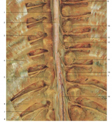 Identify number 13. What meningeal layer are these extensions part of?