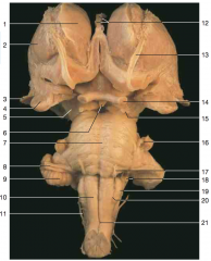 Is this an anterior or posterior view of the brainstem? How do you know?