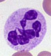 - phagocytosis (cell eating
- granular, "sandy" cytoplasm