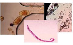 5. Deacordo com a imagem demonstrada, qual o agente etiológico desta figura? Quaisas técnicas que podem ser aplicadas para esta parasitose?