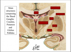 Identify caudate, corpus callosum, internal capsule, GPi, GPe, putamen, thalamus.