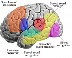 Conduction Aphasia:
- Fluency: Yes
- Comprehension: Yes
- Repetition: No