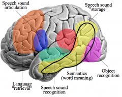 Transcortical Sensory Aphasia:
- Fluency: Yes
- Comprehension: No
- Repetition: Yes